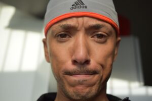 顔脂肪吸引の圧迫はいつまで続けるべきですか？