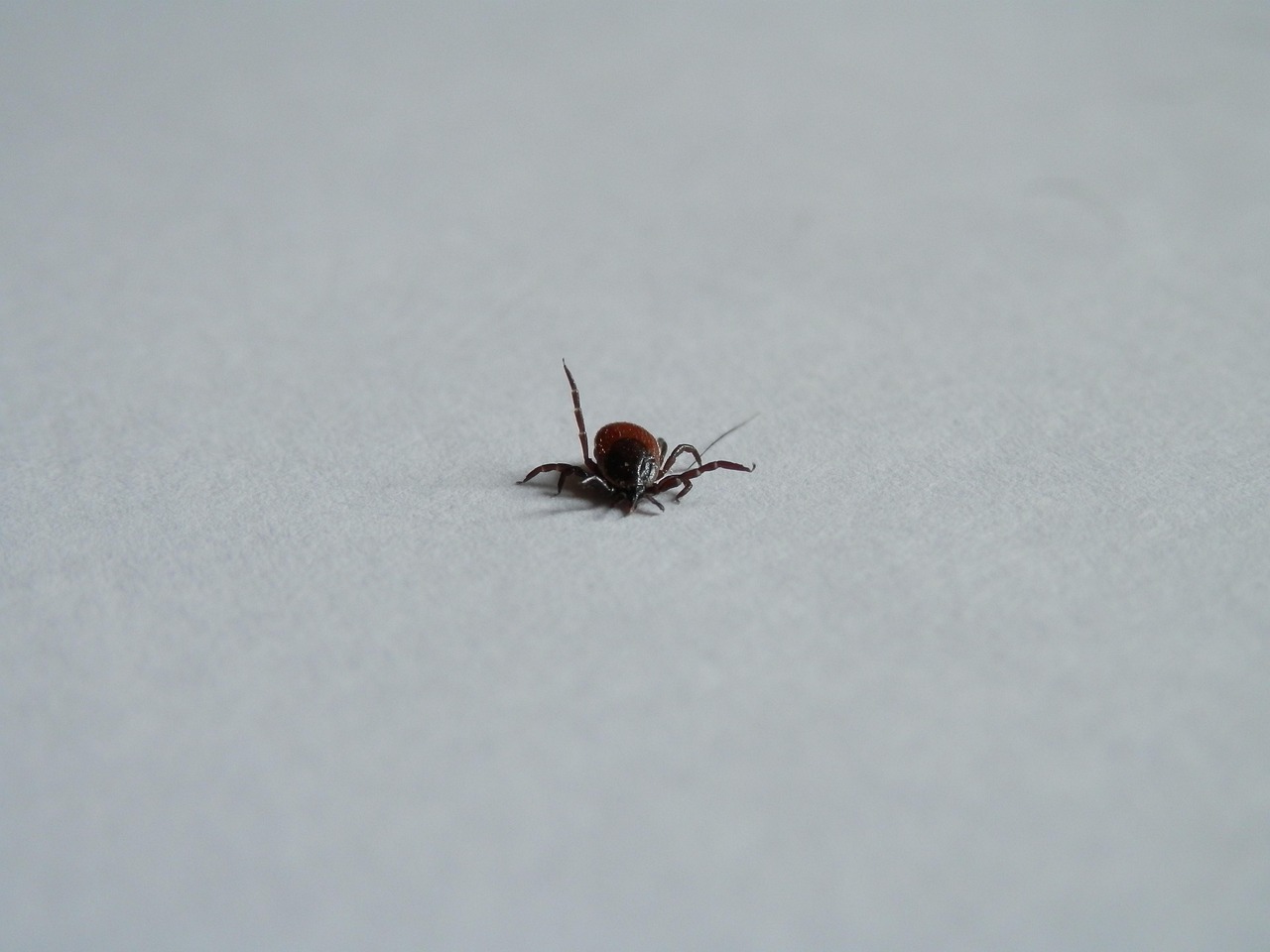 顔の脂肪吸引後のむくみをリンパで流す方法は？